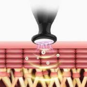 Plasma Touch cold jet